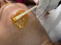 Chin Waxing